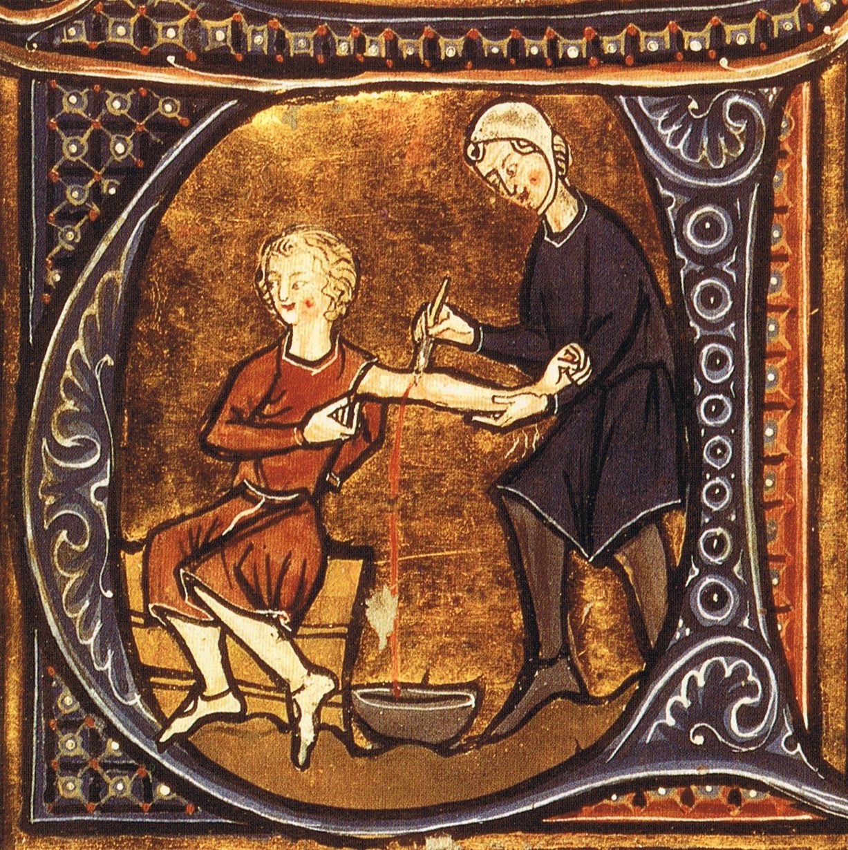 An illustration of the medieval practice of blood letting A woman is cutting into the arm of another woman using a knife. Blood is running down into a bowl in a stream of red.
