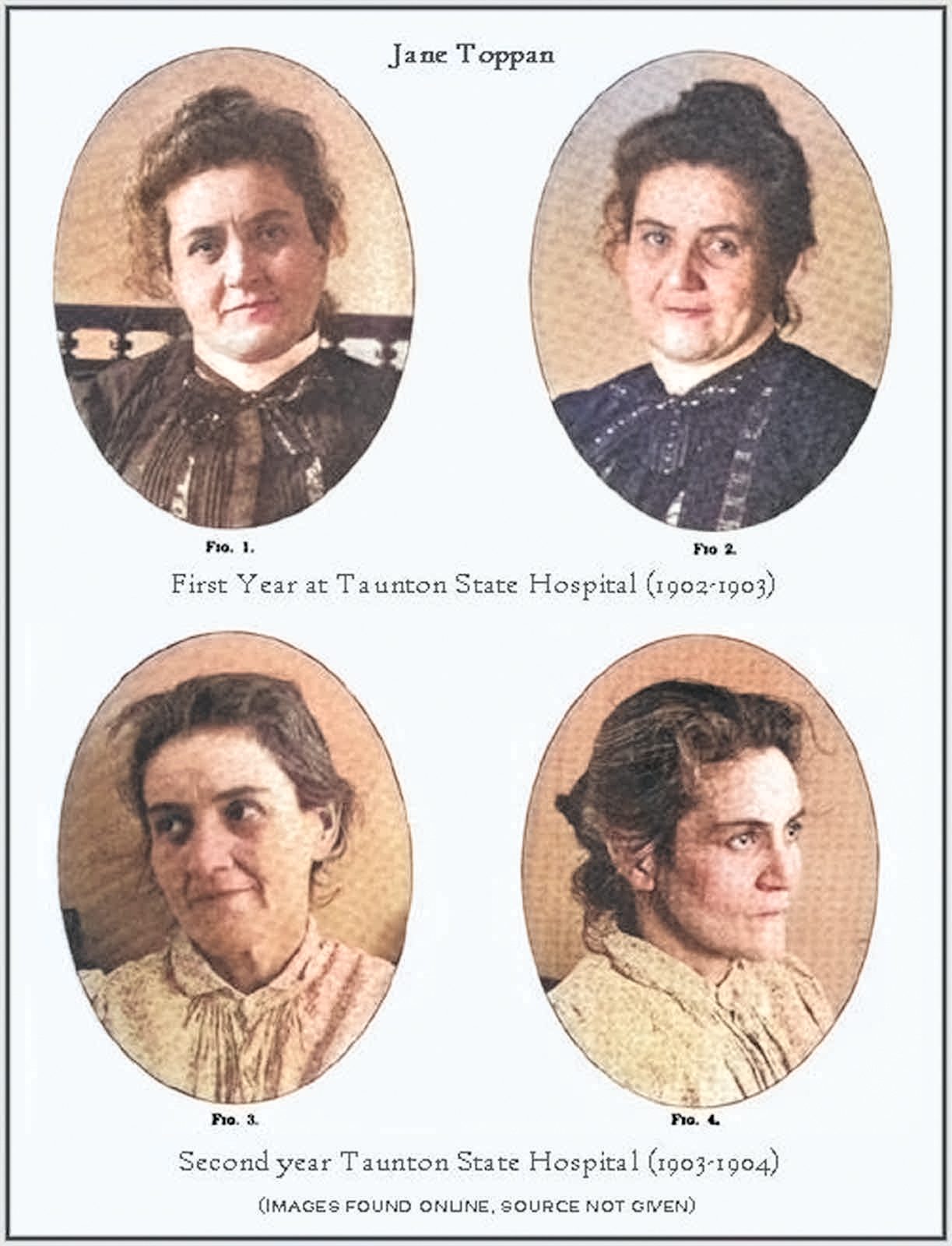 A collage of portraits of Jane Toppan as a psychiatric hospital, she has unruly hair a neutral expression on her face in all four photos.