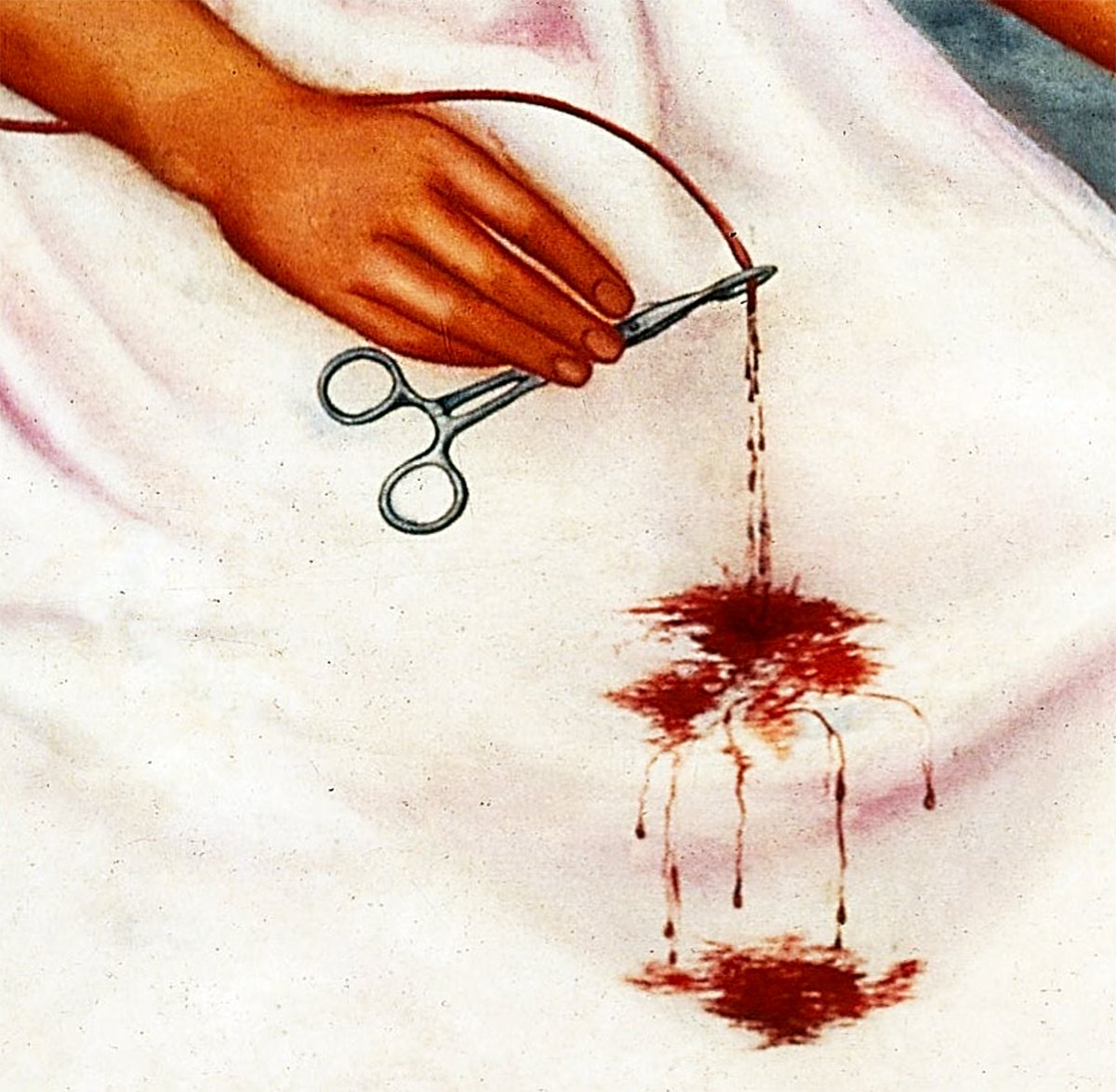 A close-up detail from Frida Kahlo's 1939 painting "The Two Fridas," focusing on a hand holding a pair of scissors, severing a vein. The cut vein is dripping blood onto the white fabric of a dress, creating a stark contrast and symbolizing emotional pain and separation. The image captures the intense and raw emotion that is characteristic of Kahlo's work.